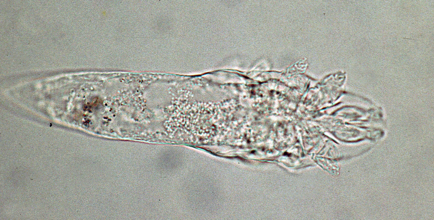 Demodex+Mites%3A+The+Guardians+of+Skin+Health